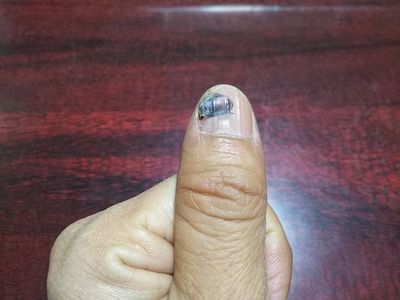 bDr6dcTdSgkfQ6qXhsxZ.jpg?w=940&h=940