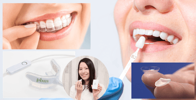 「ルミネート矯正」がもたらす革新「歯並び・白さ・形」も思いのままに