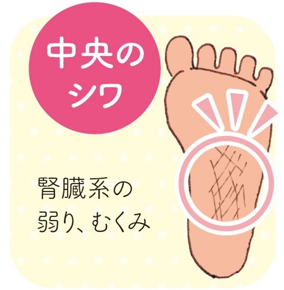 足裏のシワの場所チェックしましょう!