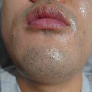 bfi81GrXduLvJ2t1gPV6.jpg?w=940&h=940