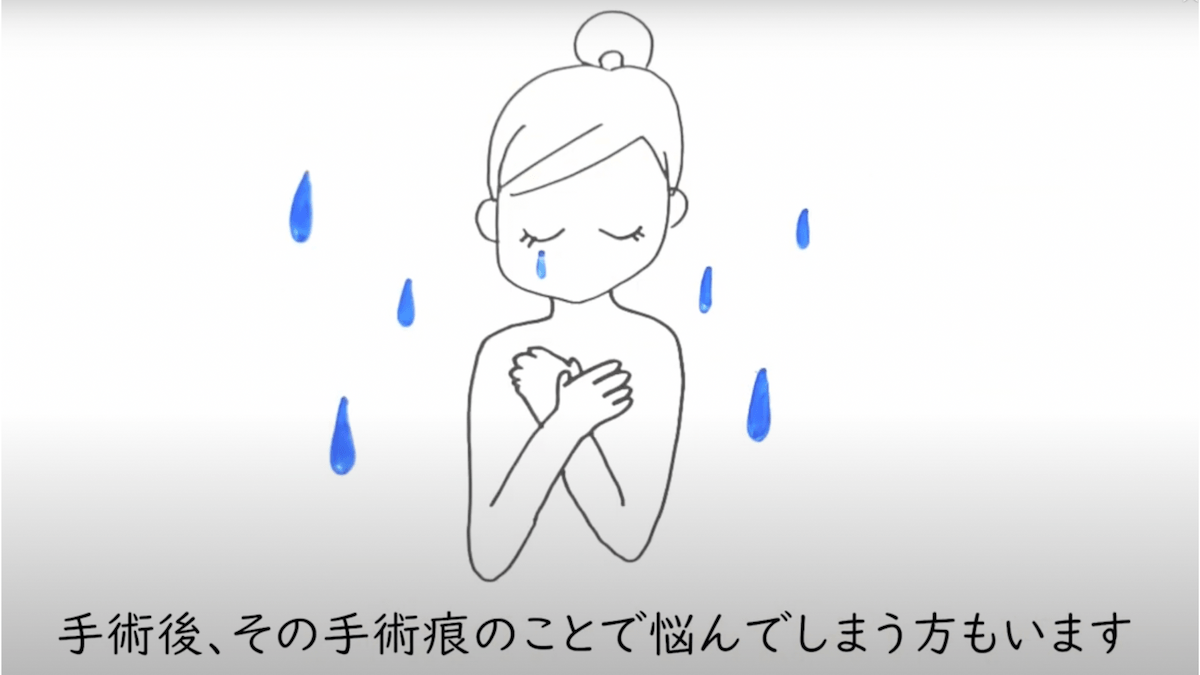 手術痕で悩む人も