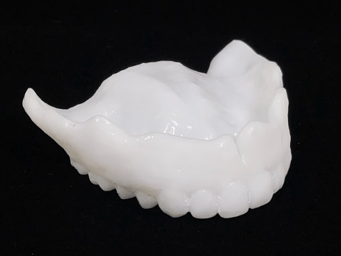 夜専用入れ歯型マウスピース 総入れ歯