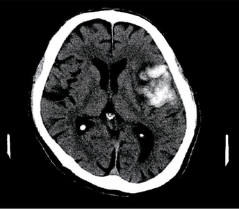 cKfdG84e8JYTRIxSClW4.jpg?w=940&h=940