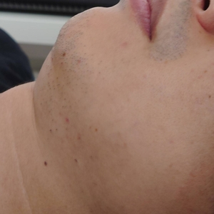 cXCQssYMjzZ9jWMVVsTf.jpg?w=940&h=940