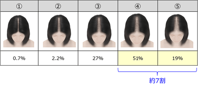 Q2. あなたは、次の頭髪状態のうち、どこからが「壮年性脱毛症」だと思いますか。あてはまるものをひとつお知らせください。