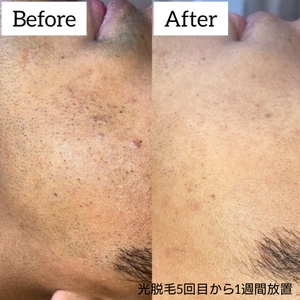 dO89IdQfabrBQF4lRq0X.jpg?w=940&h=940