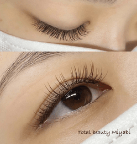 dQxk2qY75EOJAtKpovwt.png?w=940&h=940