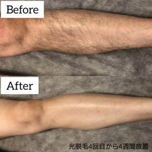 dVyDBwSlpNntqJQmKSXl.jpg?w=940&h=940