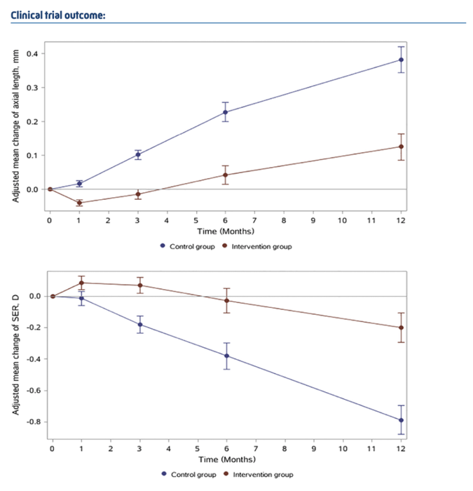 レッドライト87.7%近視進行抑制