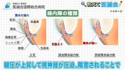 eOaW7JLirFPoaon3EKZo.png?w=940&h=940