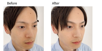 ePGlMAM0UtbkN69t6tVt.jpg?w=940&h=940