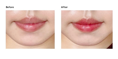 el6nEO7ooQpZW19LEPxt.jpg?w=940&h=940