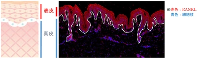 免疫と骨の健康に関わるタンパク質「RANKL」が 皮膚のバリア機能及び保湿機能を強化することを発見　 第6回日本骨免疫学会にて発表