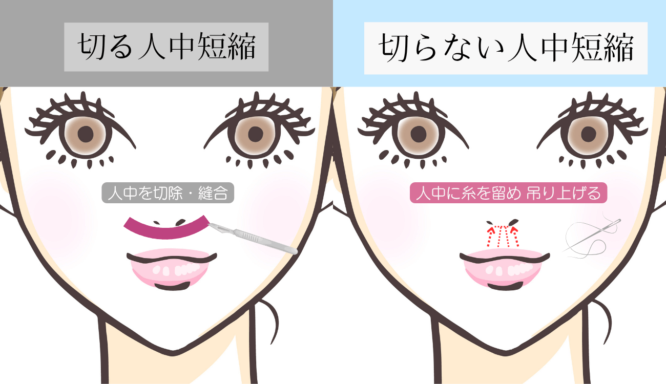 施術イメージ(1)