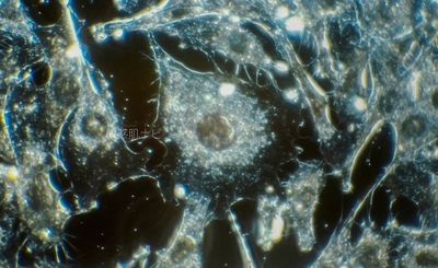 gB1RTjdZaNGi9vQMRQaj.jpg?w=940&h=940