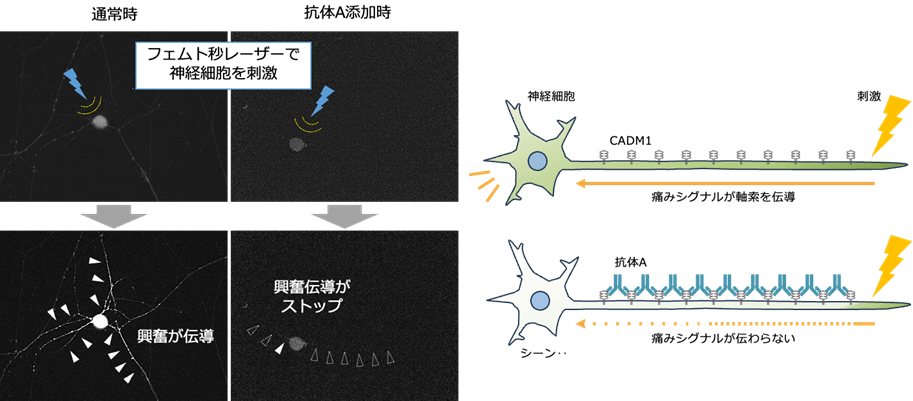 体内で神経に集積して疼痛を抑制する抗体を独自に作製　長時間効果を発揮する鎮痛薬への応用に期待