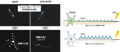 体内で神経に集積して疼痛を抑制する抗体を独自に作製　長時間効果を発揮する鎮痛薬への応用に期待
