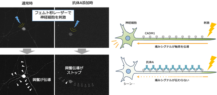 神経細胞にレーザーを照射して刺激すると、興奮が神経線維上を伝導する(通常時)。 事前に抗体Aを投与しておくと、この神経線維上の興奮伝導が停止する(抗体A添加時)。