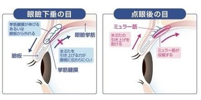 h2KYJl68G44pPsNwjEmD.jpeg?w=940&h=940