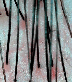 higQLaxu0cV261XToshK.png?w=940&h=940