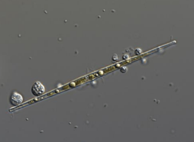 図1．植物プランクトンのイタケイソウの仲間（Ulnaria sp.）に寄生したツボカビ（Rhizophydiales sp.）が成熟し、胞子嚢（のう）になったところ