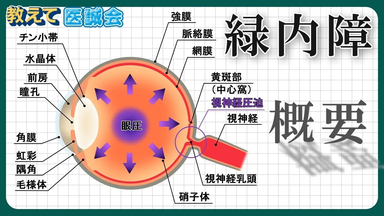 緑内障に関する正しい知識を学べる解説動画を公開 / 教えて医誠会