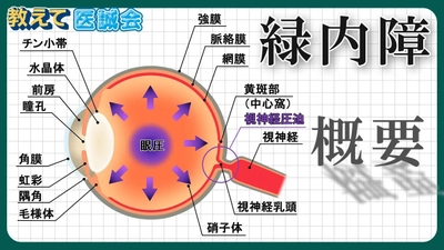 緑内障に関する正しい知識を学べる解説動画を公開 / 教えて医誠会
