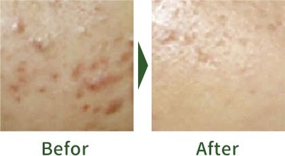 jbSLvBHQ6pxcDAX6XkCJ.jpg?w=940&h=940