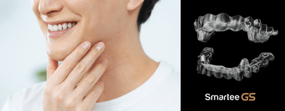 世界が認める「Smartee（スマーティー）」の実力