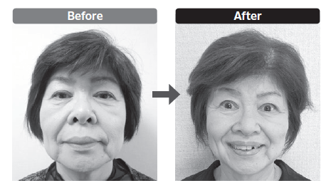 体験者のビフォーアフター(本文より)