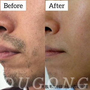 nN3kyDXJKaq0koEvgvXR.jpg?w=940&h=940