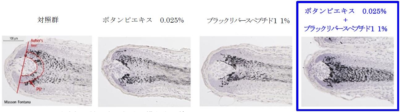 Auber's line:毛球部の最も太い部分を横断する線 PU:メラニン量測定エリア