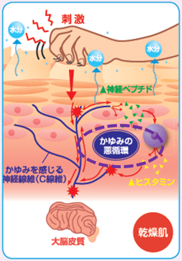 かゆみの悪循環