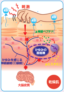 かゆみの悪循環