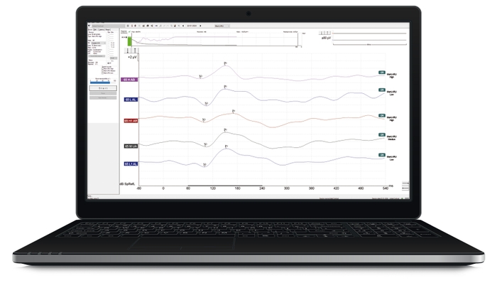 皮質聴覚誘発電位検査画面