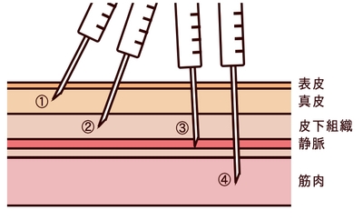 ow5IGUEYtAFBVRdljZVy.jpg?w=940&h=940