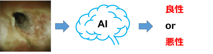 図2:AIによる胆道鏡画像の良悪性診断支援のイメージ