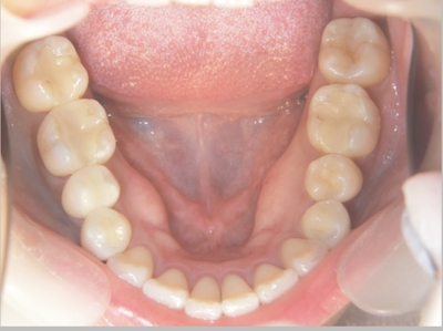 qDF9B9OSnSZS3xLKfQqn.jpeg?w=940&h=940