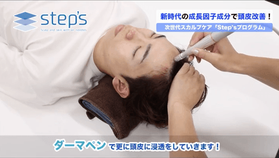 qH5f4bOhfP3CHRuAc17S.png?w=940&h=940