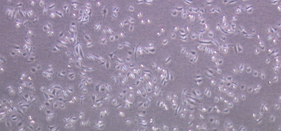 悪性度の高い前立腺がんを診断する新たな高感度測定法を確立　患者負担を少なく、短時間で効率的ながんの検出を可能に