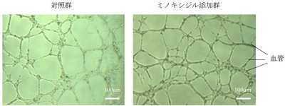 図２．ミノキシジル添加による血管網形成の促進