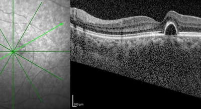 r9bnoAHWMPzerGGe4GYA.jpg?w=940&h=940