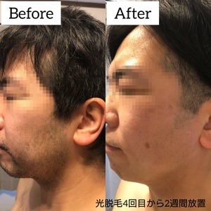 rRsHr7kya026RNC45A4g.jpg?w=940&h=940