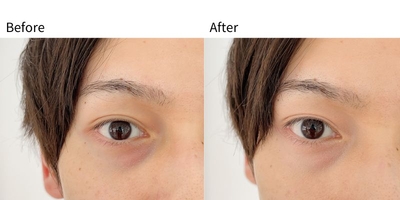 ro2ISqylWtpWWqxwEGKL.jpg?w=940&h=940