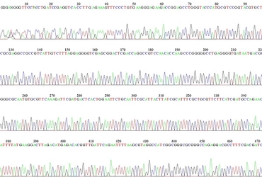 [奈文研コラム] 文化財とPCR