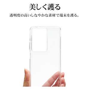 sPNaUOsjD9nWeITOH9UL.jpg?w=940&h=940