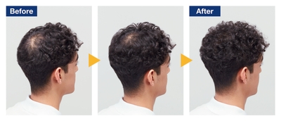 sZdPAvPPO6DIM5y1wtEX.jpg?w=940&h=940