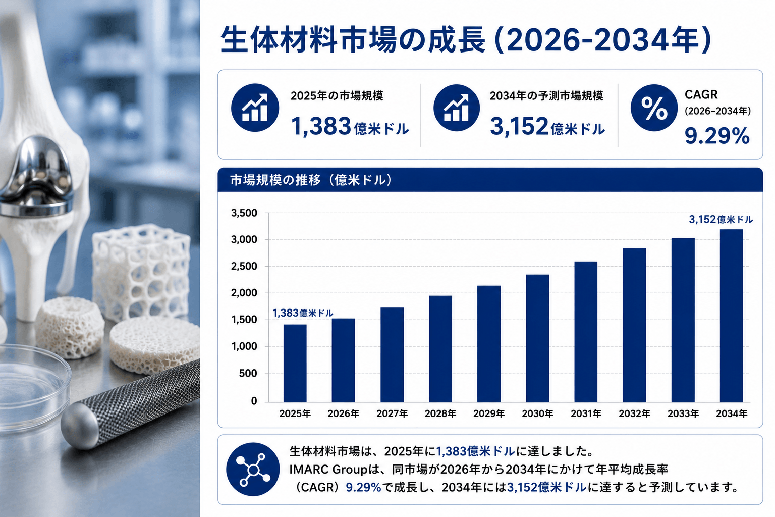 生体材料市場規模、2034年までに3,152億米ドルに到達へ――2026年～2034年の年平均成長率は9.29%