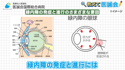 sgyC1GlwSbN8yoDBuUfq.png?w=940&h=940