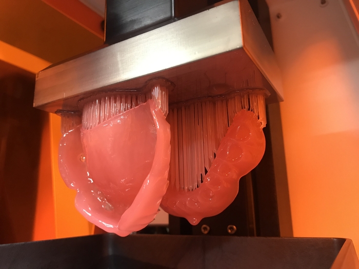 3Dプリンターによる義歯床部分の作製